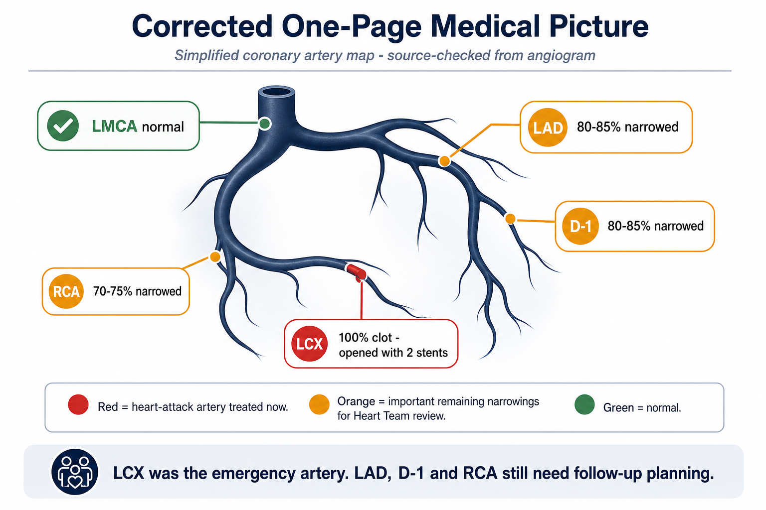 Simplified artery picture showing LCX treated and remaining LAD, D-1, RCA narrowing