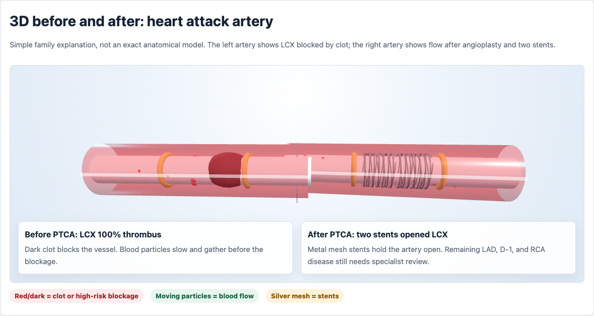Fallback preview of the 3D artery before and after model